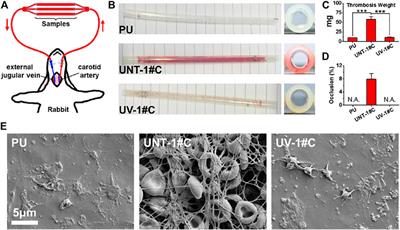 Enhanced Hemocompatibility of Silver Nanoparticles Using the Photocatalytic Properties of Titanium Dioxide